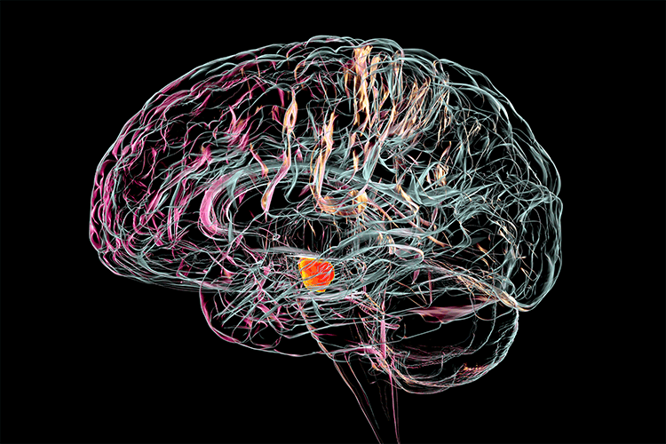 Parkinson: una nueva investigación